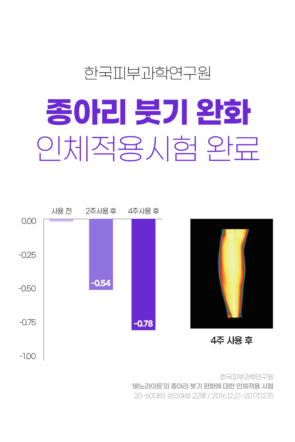 상세정보 2
