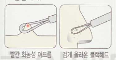 상세정보 2