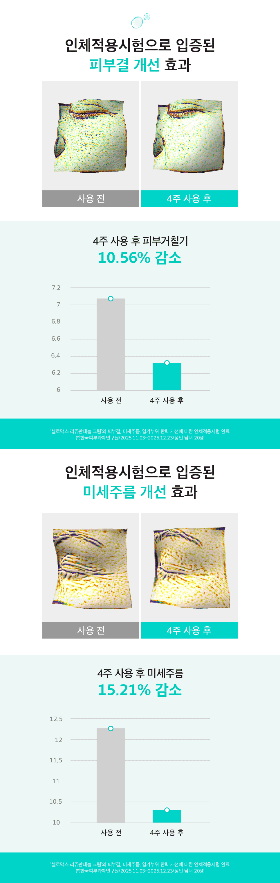상세정보 2